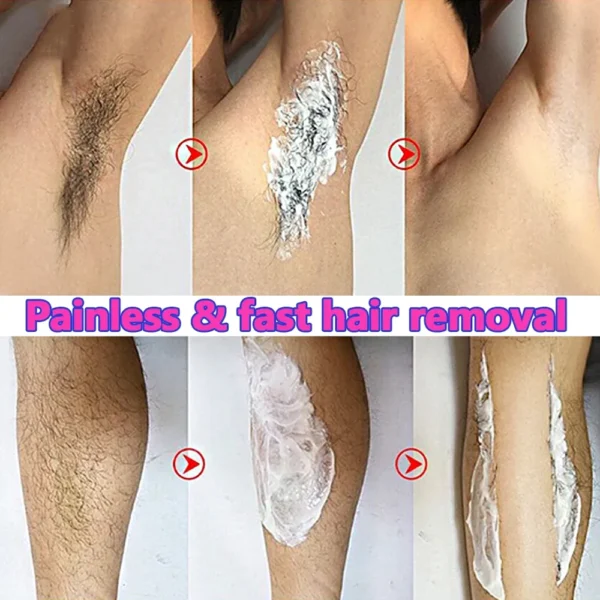 Creme Depilatório Permanente Depilador Creme Áreas Íntimas Saúde Removedor de Pelos Indolor Inibidor de Crescimento para Homens e Mulheres Cuidados com o Corpo - Imagem 2
